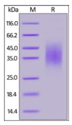 Human CD58, His Tag on SDS-PAGE under reducing (R) condition. The gel was stained overnight with Coomassie Blue. The purity of the protein is greater than 95%.